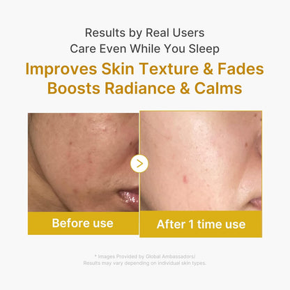 Medicube Kojic Acid & Turmeric Mask