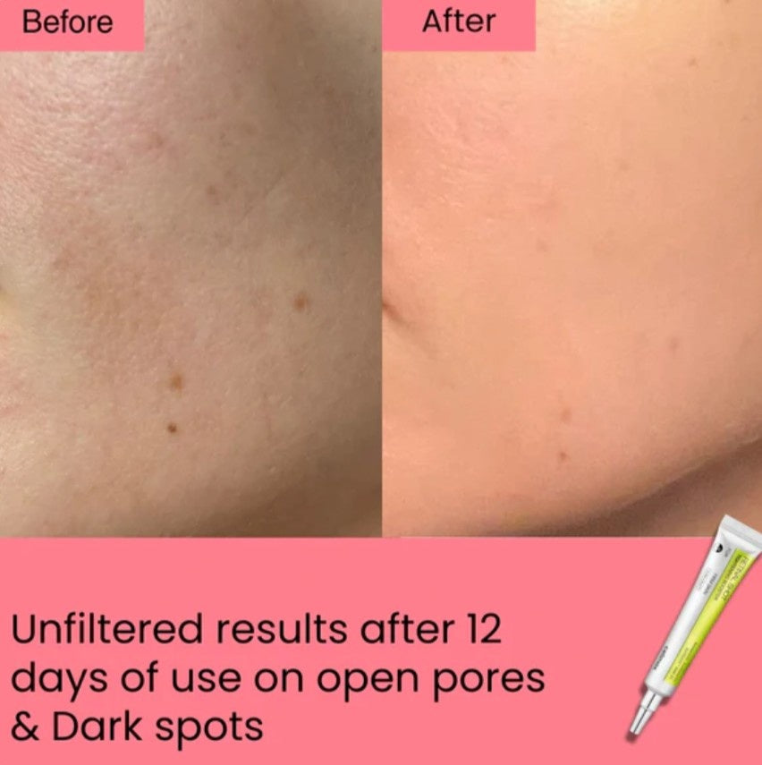 Celimax™ Vita-A Retinal Shot (15ml)