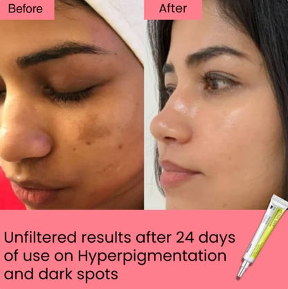 Celimax™ Vita-A Retinal Shot (15ml)