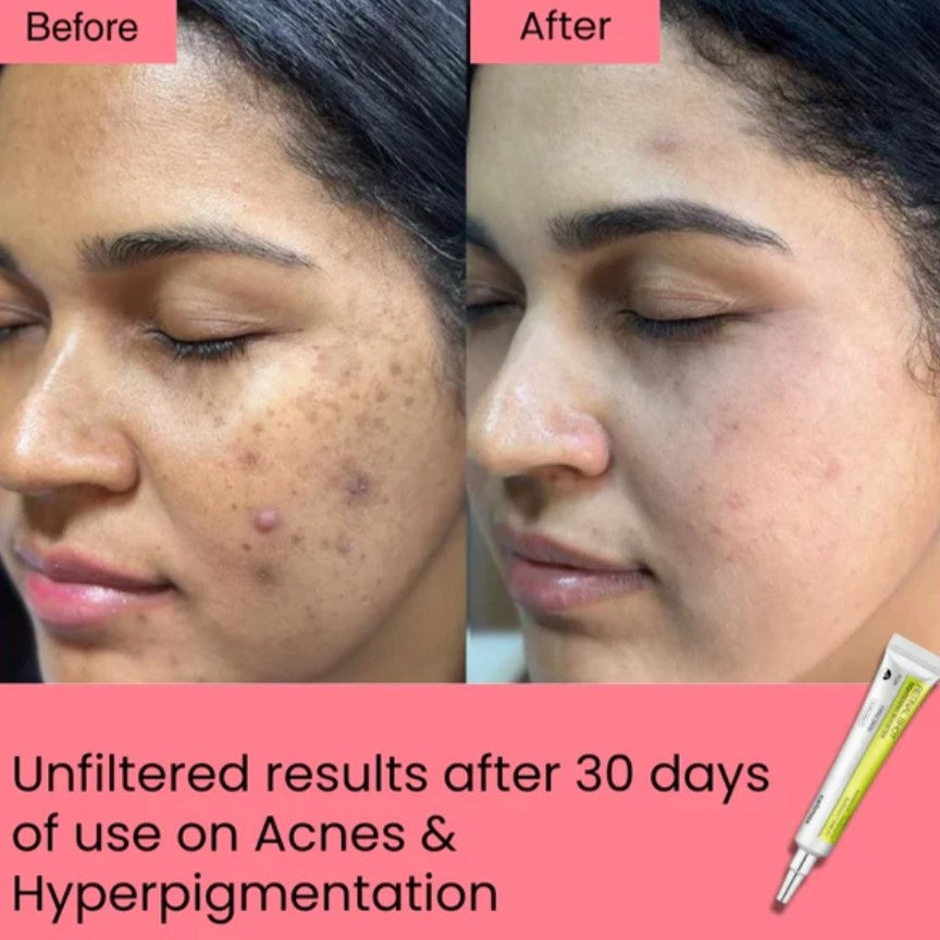 Celimax™ Vita-A Retinal Shot (15ml)