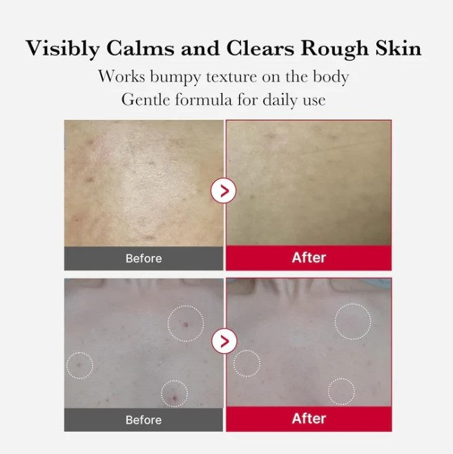 Medicube Red Body Peeling Shot, AHA + BHA Exfoliating Body Spray