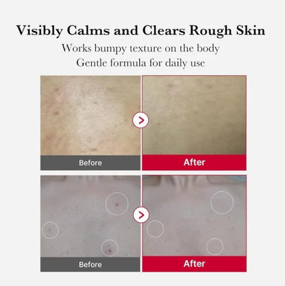 Medicube Red Body Peeling Shot, AHA + BHA Exfoliating Body Spray